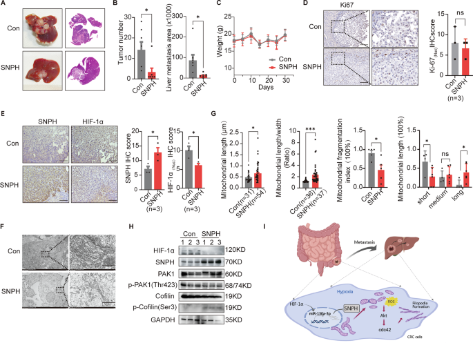 Fig. 7: SNPH up-regulation inhibited liver metastasis of CRC cells in vivo.