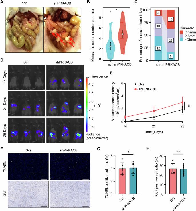 Fig. 3: In vivo experiments demonstrate that low PRKACB expression promotes metastasis in DGC.