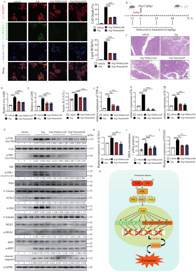 Fig. 8: Inhibition of FAK/SRC signaling Protects Pancreas from Acute Pancreatitis by Suppressing Ferroptosis.