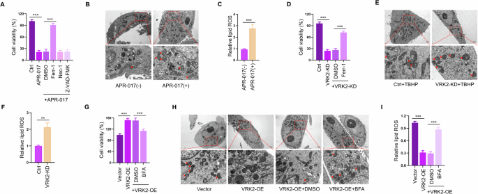 Vaccinia-related kinase 2 inhibition elicits vulnerability of glutathione  metabolism in pancreatic cancer | Cell Death & Disease