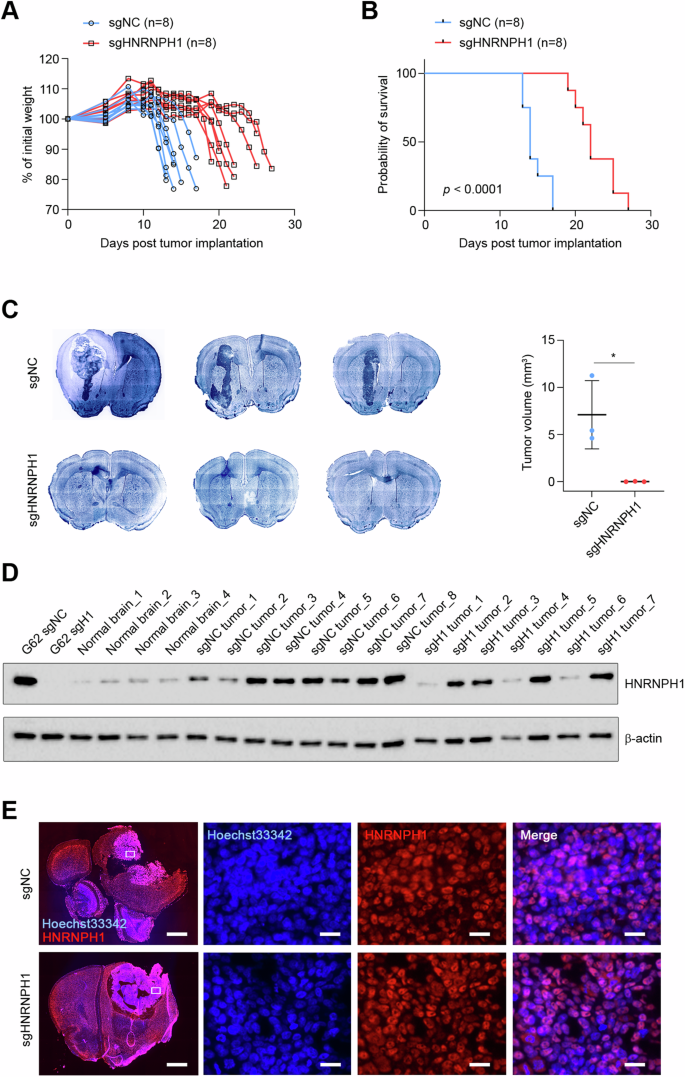 Fig. 6: Silencing HNRNPH1 reduces tumor progression in vivo.