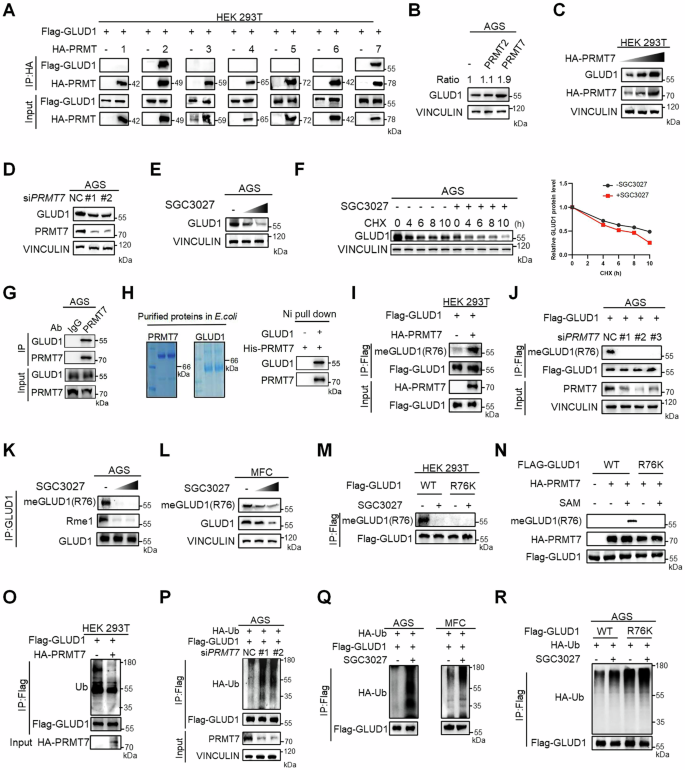 Fig. 3: PRMT7 directly methylates GLUD1 at R76.