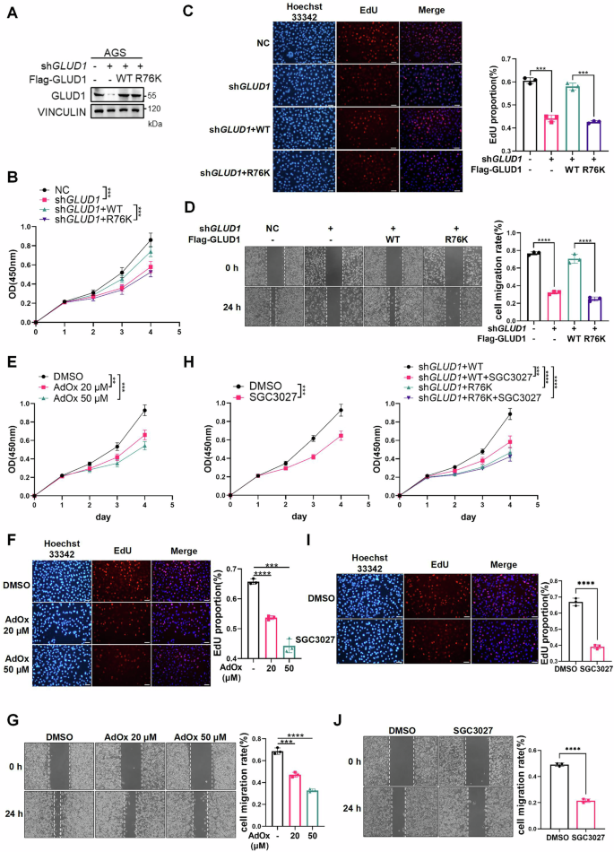 Fig. 6: PRMT7-mediated R76 methylation of GLUD1 promotes gastric cancer proliferation and migration.