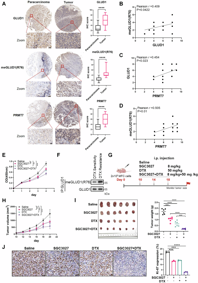 Fig. 7: PRMT7-mediated GLUD1 methylation enhances gastric cancer growth and targeting PRMT7 boosts the therapeutic efficacy of DTX.