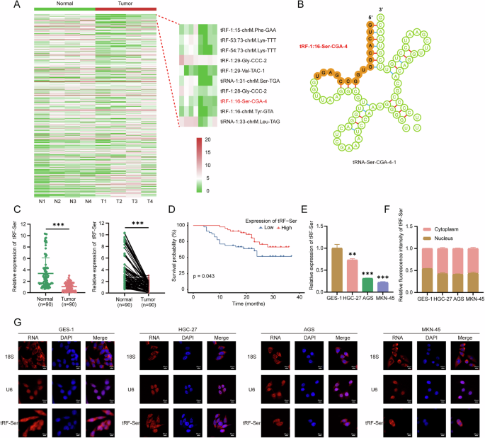 Fig. 1: tRF-Ser is downregulated in GC and correlates with favorable prognosis.