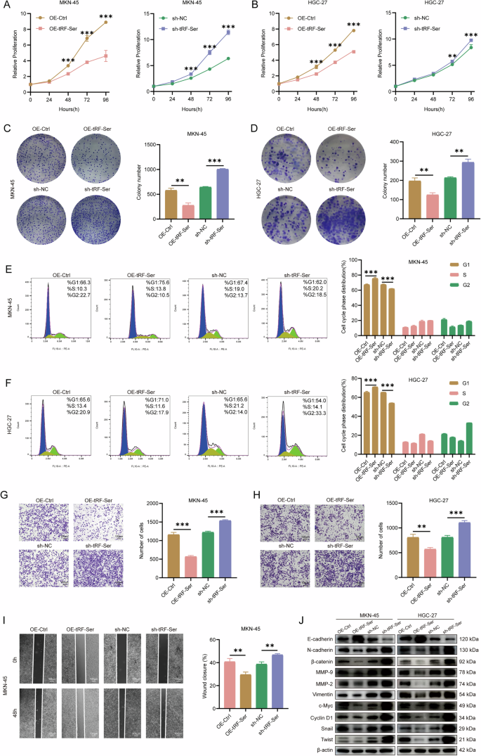 Fig. 2: tRF-Ser inhibits GC progression in vitro.