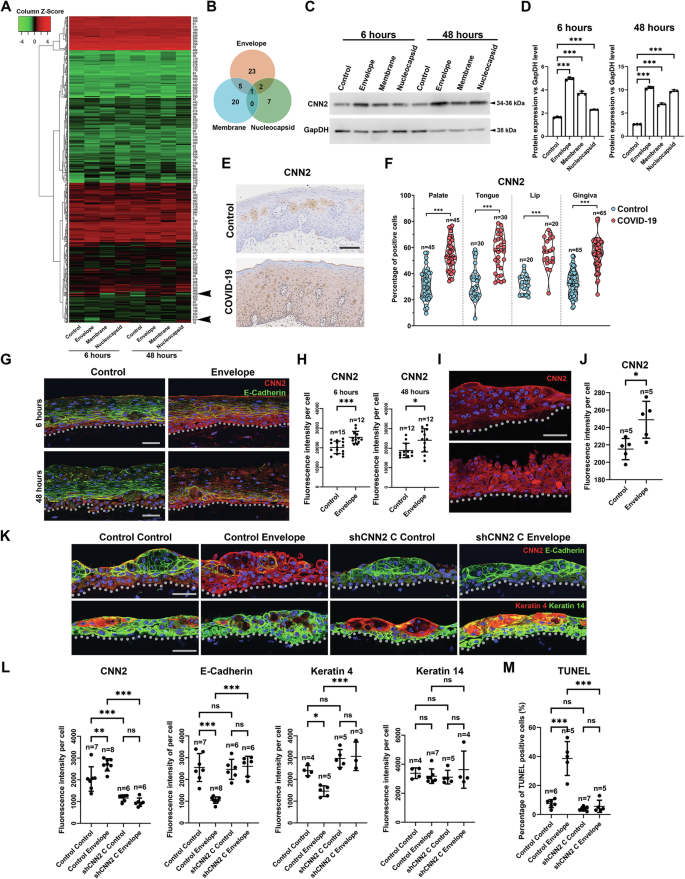 Fig. 5: CNN2 is a functional target of SARS-CoV-2 nonspike structural proteins.