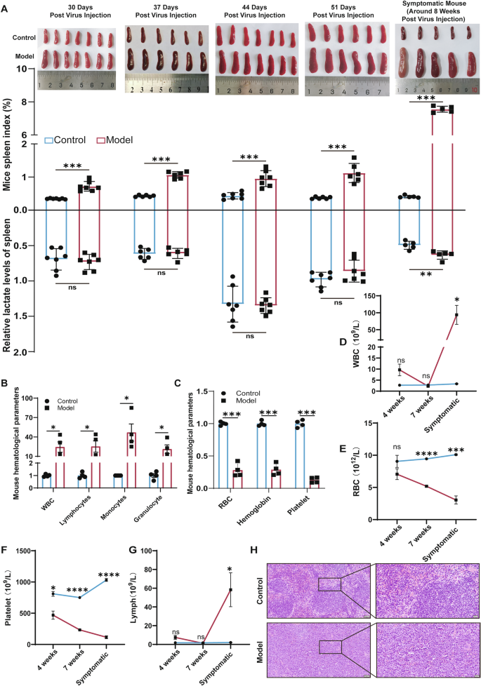 Fig. 1: Splenomegaly precedes intrasplenic lactate accumulation in AEL model mice.