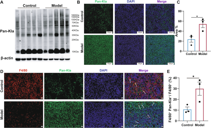 Fig. 4: Upregulation of lactylation in the spleen and macrophages of symptomatic AEL model mice.