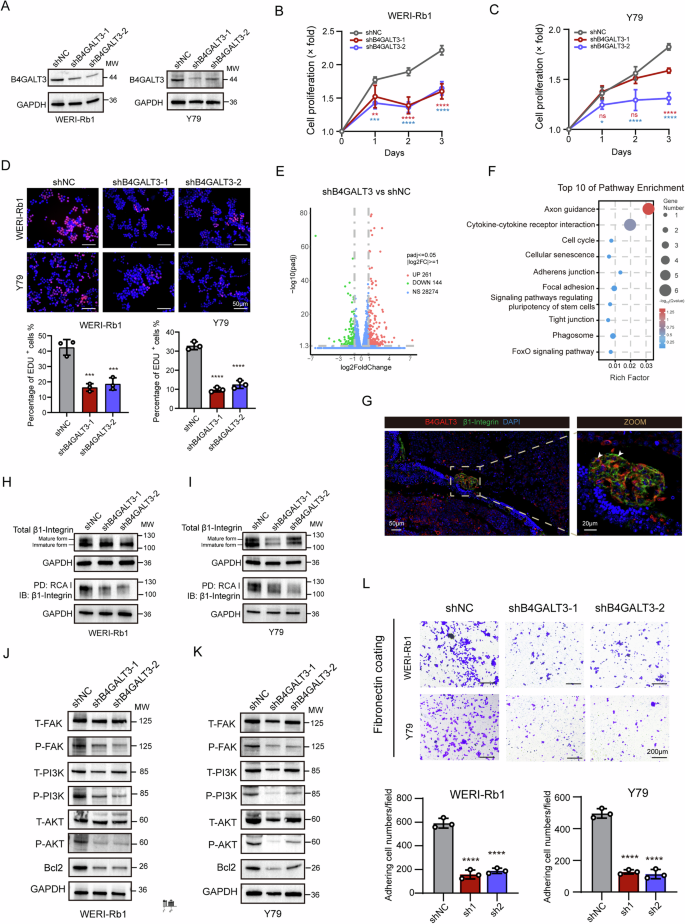 Fig. 2: B4GALT3 knockdown disrupts β1-integrin glycosylation and cell adhesion in retinoblastoma.