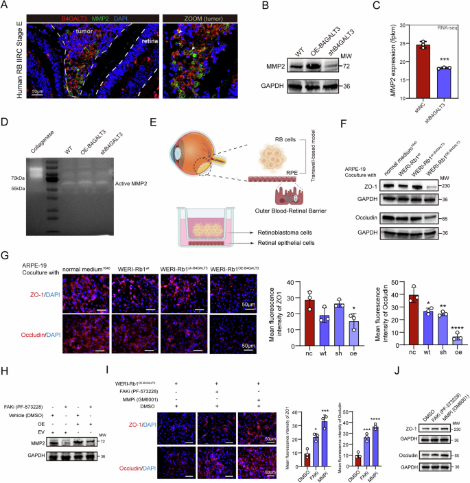 Fig. 4: B4GALT3 Promotes RB Invasion by Modulating the FAK-MMP2 Axis.