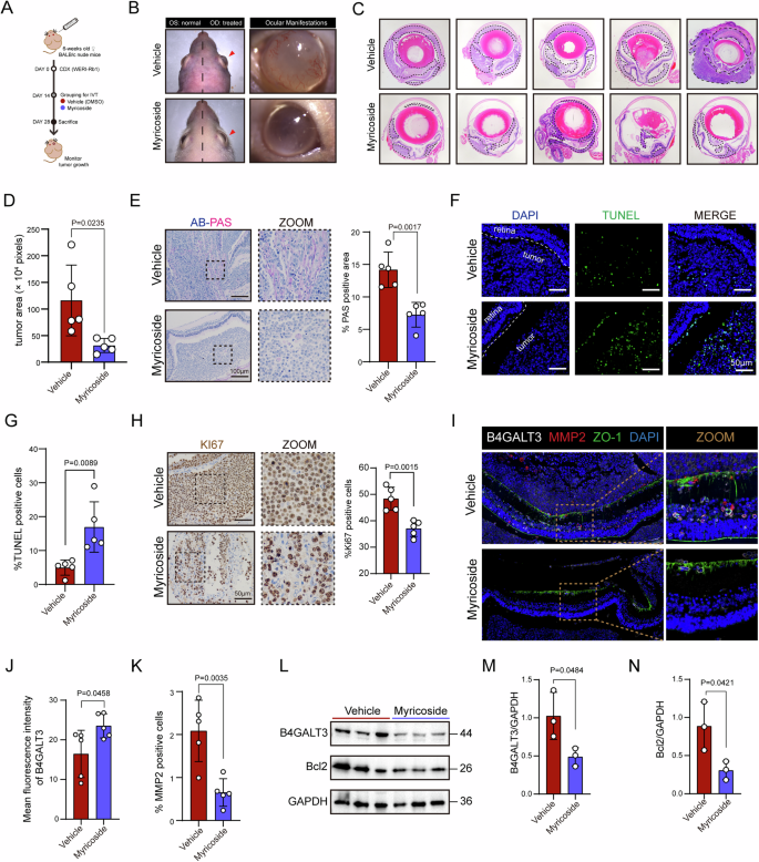 Fig. 7: Myricoside treatment inhibits retinoblastoma growth and invasion in vivo.
