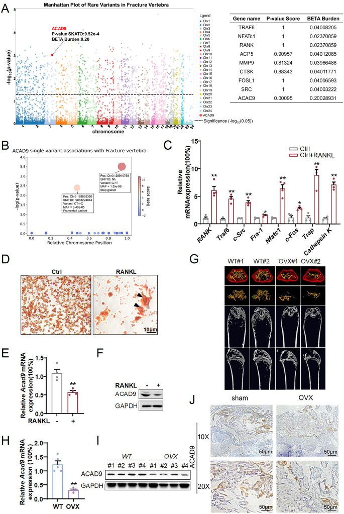 Fig. 1: ACAD9 expression is downregulated during osteoclast differentiation and osteoporosis.