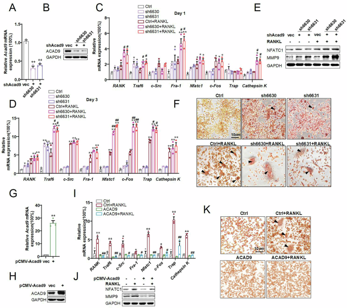 Fig. 2: Downregulation of ACAD9 promotes osteoclast differentiation and maturation.