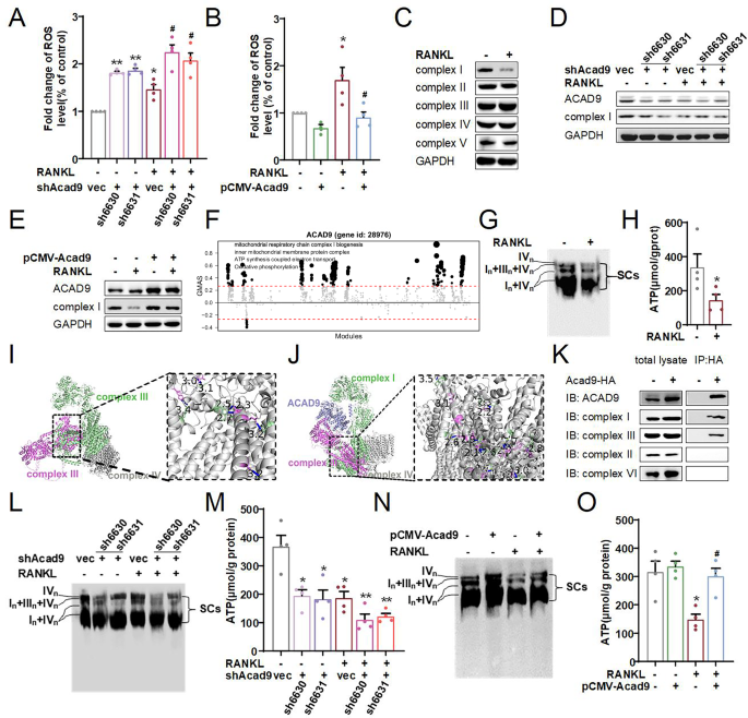 Fig. 3: ACAD9 decreases ROS production by promoting the assembling of mitochondrial complex I and SCs, thereby inhibiting osteoclast differentiation.