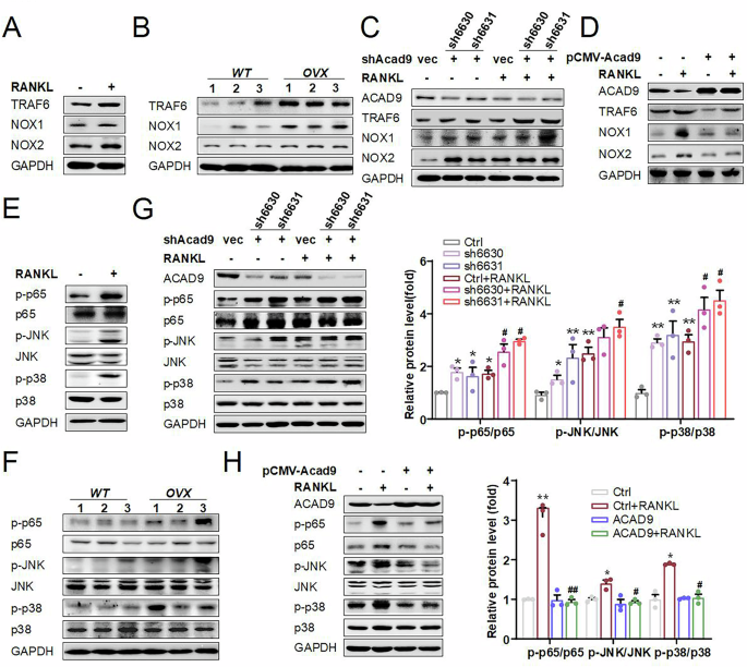 Fig. 4: ACAD9 inhibits TRAF6-mediated activation of NOX1/2 and MAPK/NF-κB signaling pathways during osteoclastogenesis.