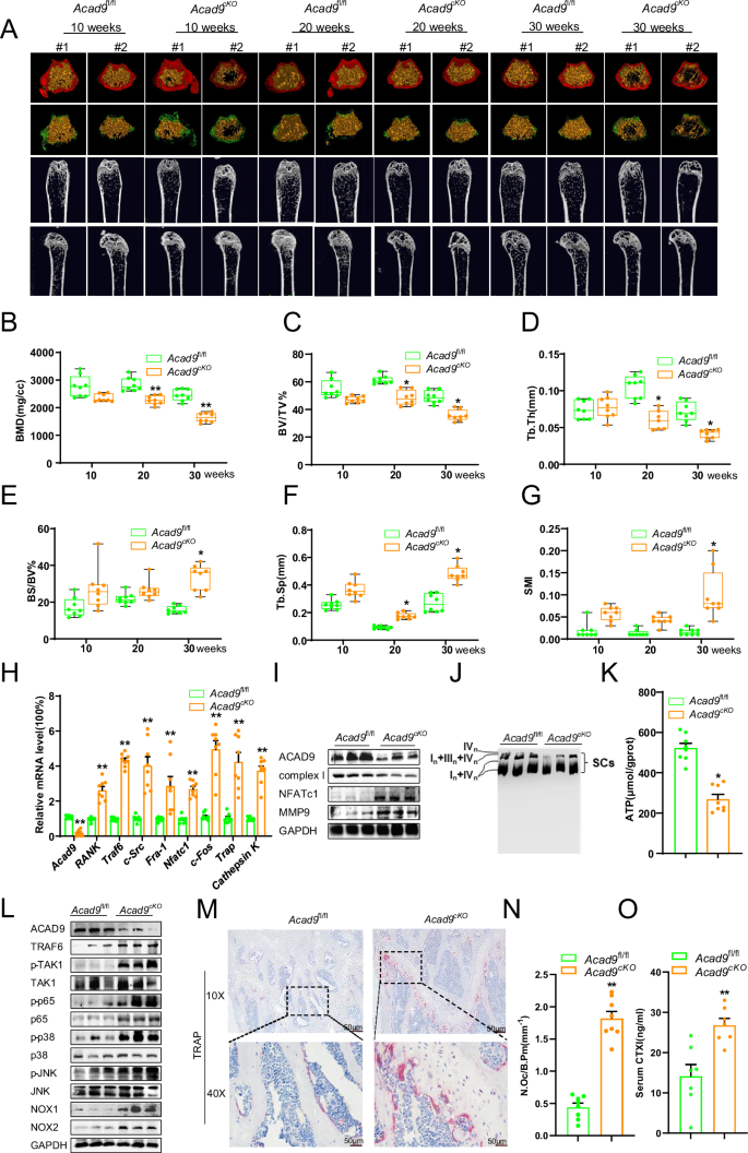 Fig. 6: Loss of Acad9 in osteoclast precursors provokes osteoporosis in mice.