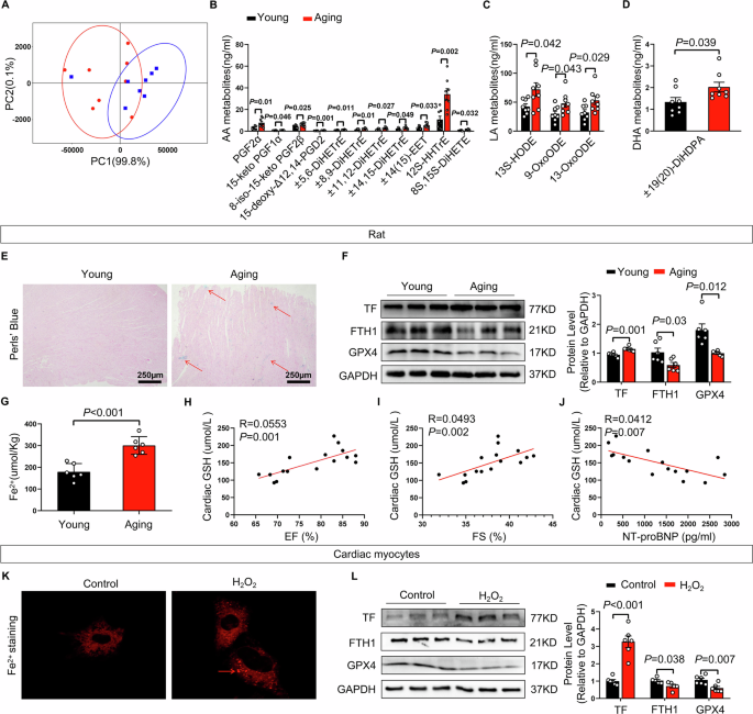 Fig. 2: Aging rats displayed increased oxidative stress and aggravated ferroptosis.