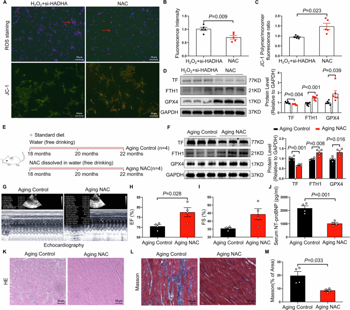 Fig. 5: NAC supplementation restrains ferroptosis in cardiomyocytes and protects aging rats from cardiac dysfunction.