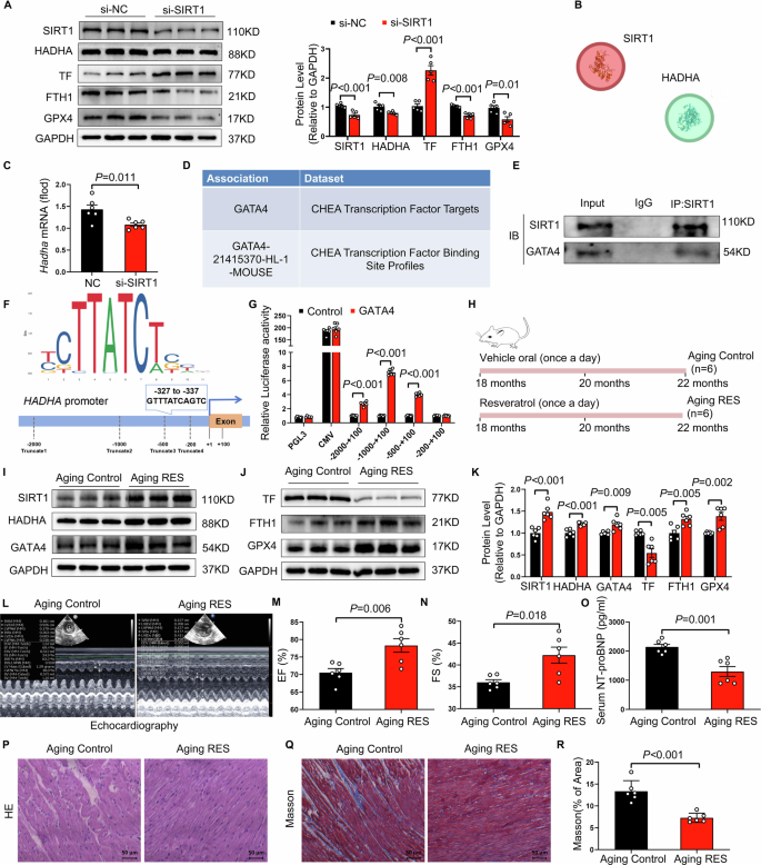 Fig. 6: SIRT1 deficiency suppresses HADHA expression through inhibition of GATA4, whereas resveratrol supplementation preserves cardiac function in aging rats.