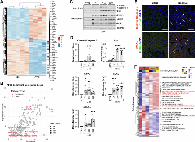 Fig. 1: Upregulation of apoptosis and necroptosis signaling pathways during AKI-to-CKD transition.