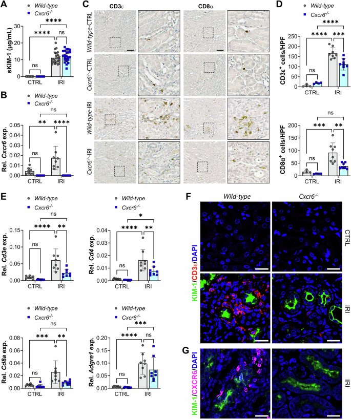Fig. 3: CXCR6 promotes T cell accumulation in late-stage ischemia/reperfusion injury (U-IRI).