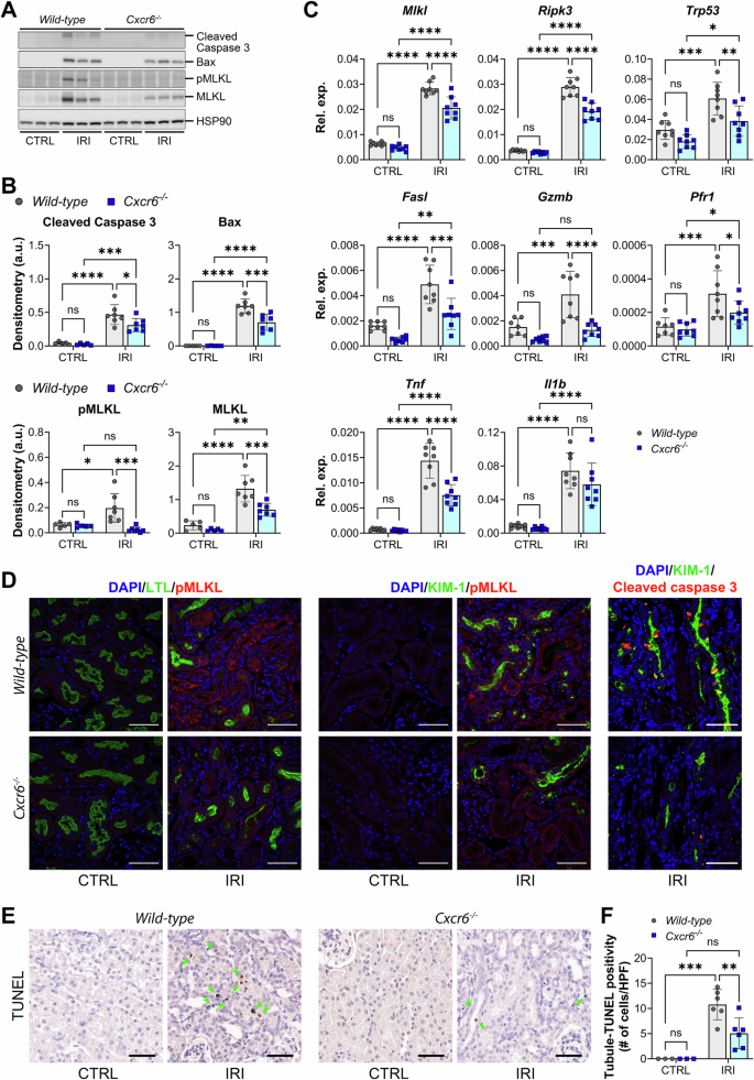 Fig. 4: CXCR6 promotes proximal tubule (PT) injury via apoptosis and necroptosis.