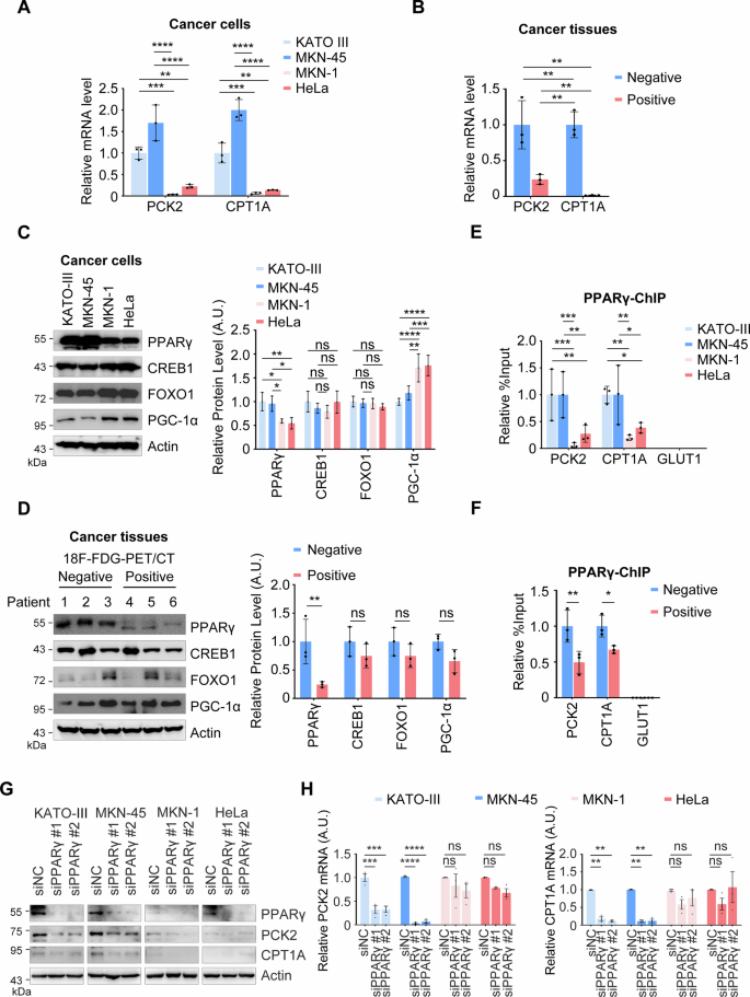 Fig. 5: PPARγ upregulation drives the transcription of PCK2 and CPT1A in 18F-FDG-PET/CT-negative gastric cancer.