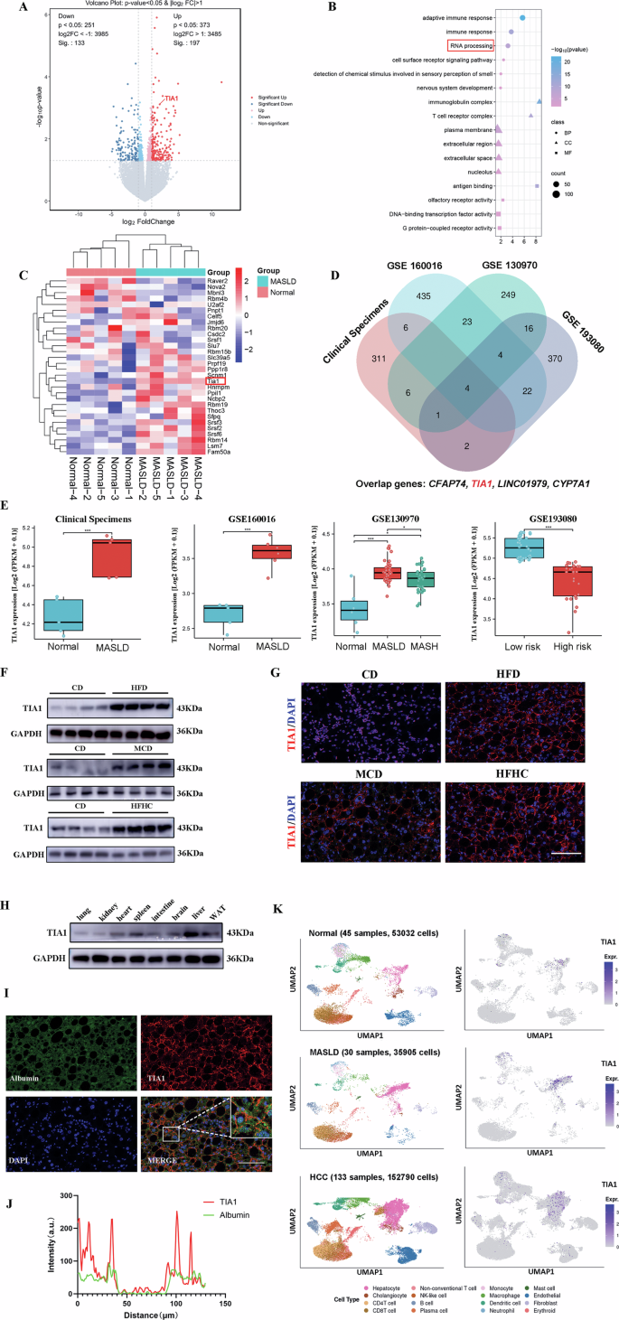 Fig. 1: Elevated hepatic TIA1 levels under metabolic stress exhibit negative correlation with MASH progression.