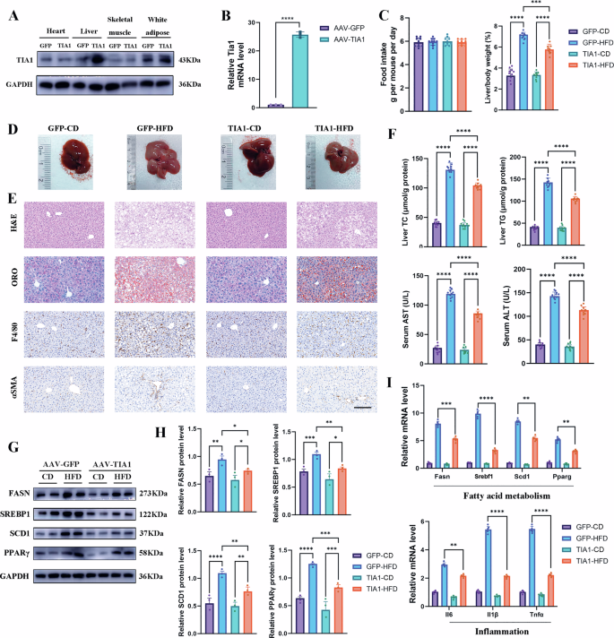 Fig. 3: Reconstitution of TIA1 attenuates HFD-induced MASLD and hepatocellular injury.
