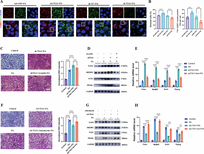 Fig. 5: Hepatocyte TIA1 is essential for SGs formation during PA-induced hepatic injury.