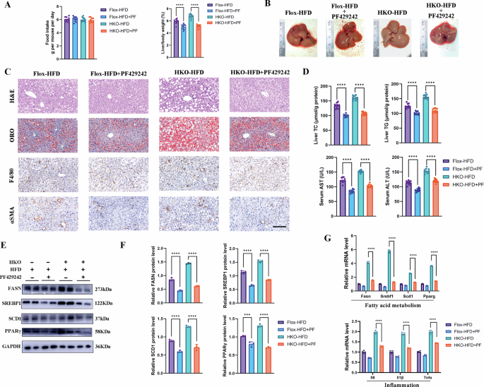Fig. 7: Pharmacological inhibition of SREBP1 rescues the exacerbated MASLD phenotype in TIA1-deficient mice.