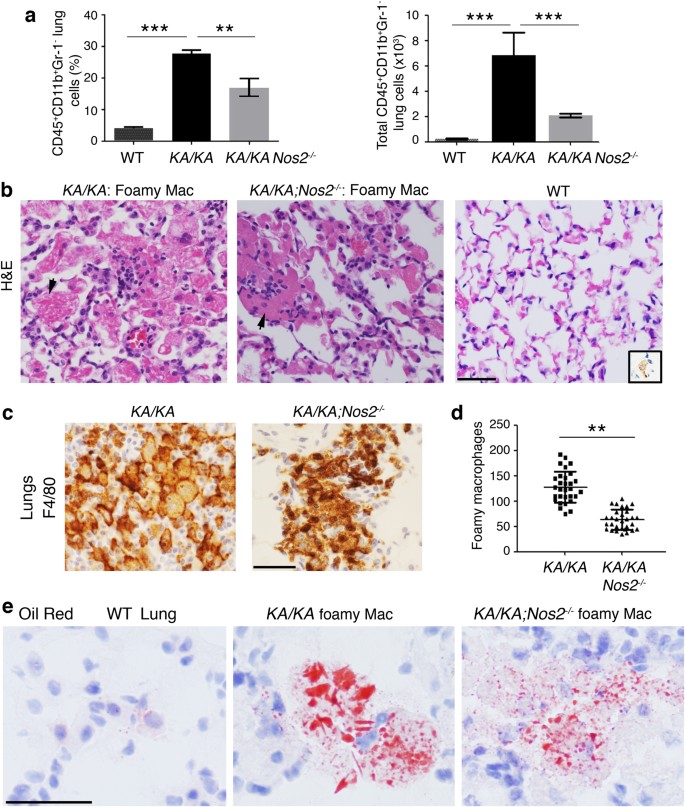 Fig. 3: NOS2 deletion reduces infiltrating macrophage and foamy macrophage numbers in KA/KA lungs.