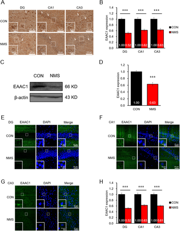 Fig. 4: Expression of EAAC1 in the ventral hippocampus of NMS rats in adolescence.