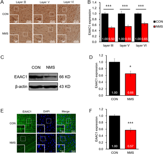 Fig. 5: Expression of EAAC1 in the cortex of NMS rats.