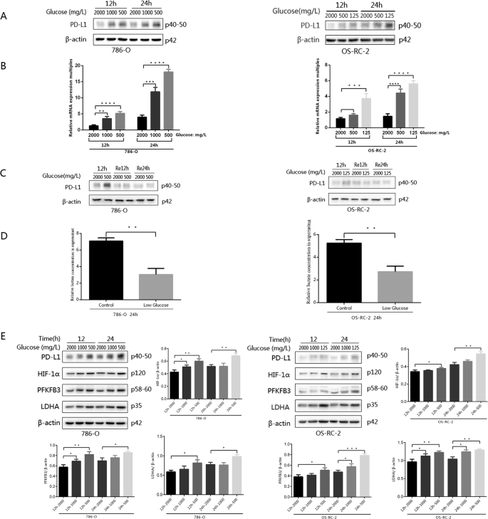 Glucose Metabolism Involved In Pd L1 Mediated Immune Escape In The Malignant Kidney Tumour Microenvironment Cell Death Discovery