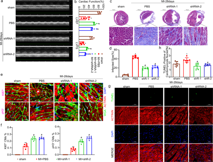 Fig. 6: IGFBP-1 depletion increased functional recovery and myocardial repair 28 days after MI in mice.