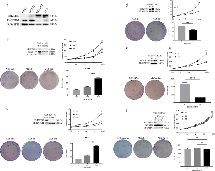 Fig. 3: OTUB2-promoting gastric cancer cell proliferation is coincident with KRT80 in vitro.