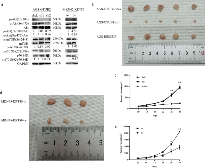 Fig. 6: OTUB2 regulates KRT80, thereby activating the Akt signaling pathway, which results in the tumorigenesis and proliferation of GC in vivo.