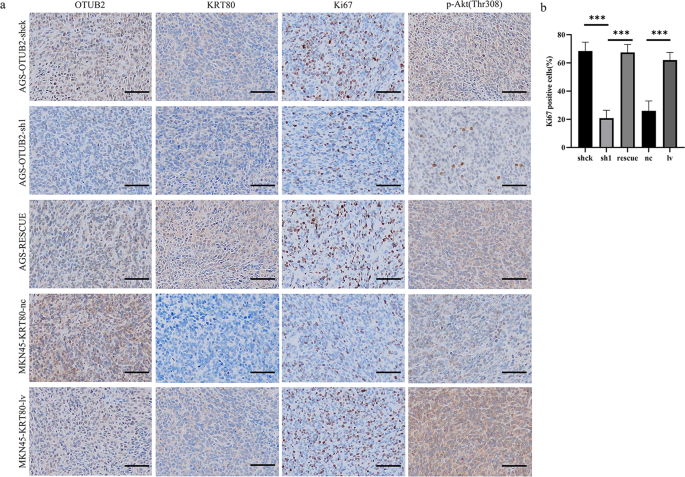 Fig. 7: IHC staining in nude mouse xenograft tumors.