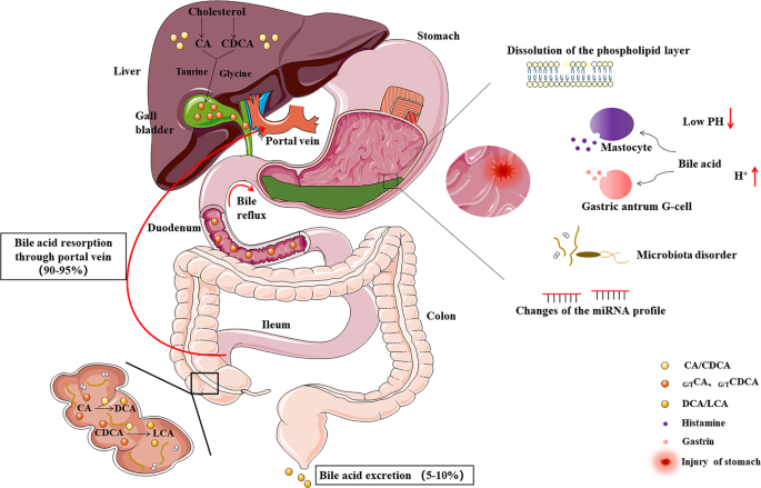 Roles and action mechanisms of bile acid-induced gastric intestinal  metaplasia: a review | Cell Death Discovery