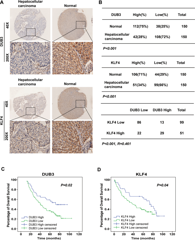 Fig. 7: DUB3 expression positively correlated with KLF4 expression in HCC tissue samples and overall survival in HCC patients.