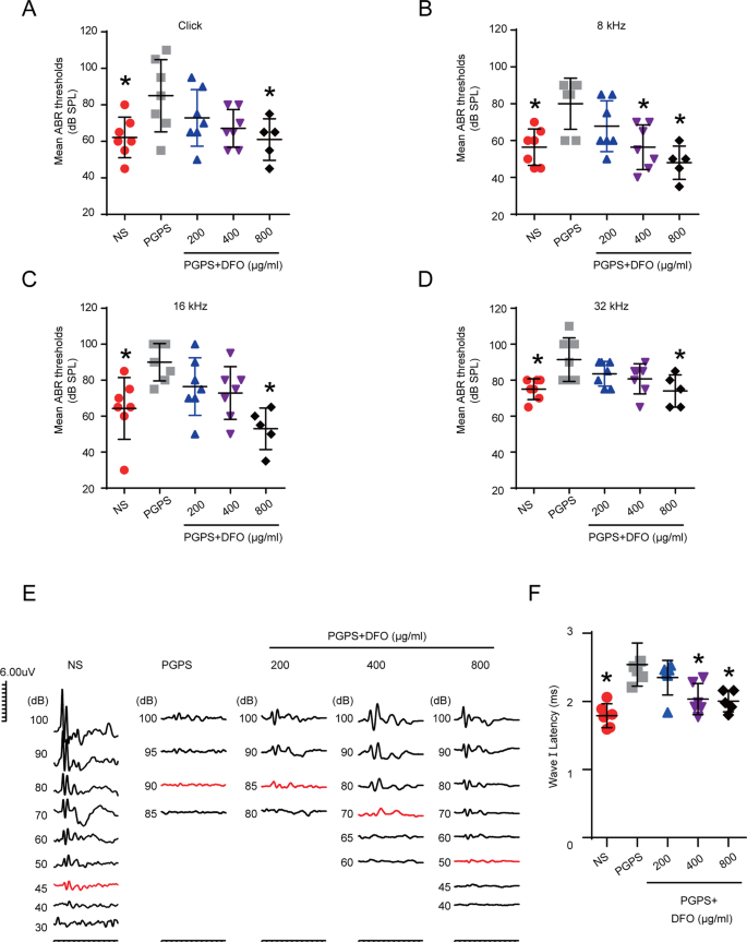 Fig. 2: DFO improves the ABR threshold in mice with PGPS-induced OM.