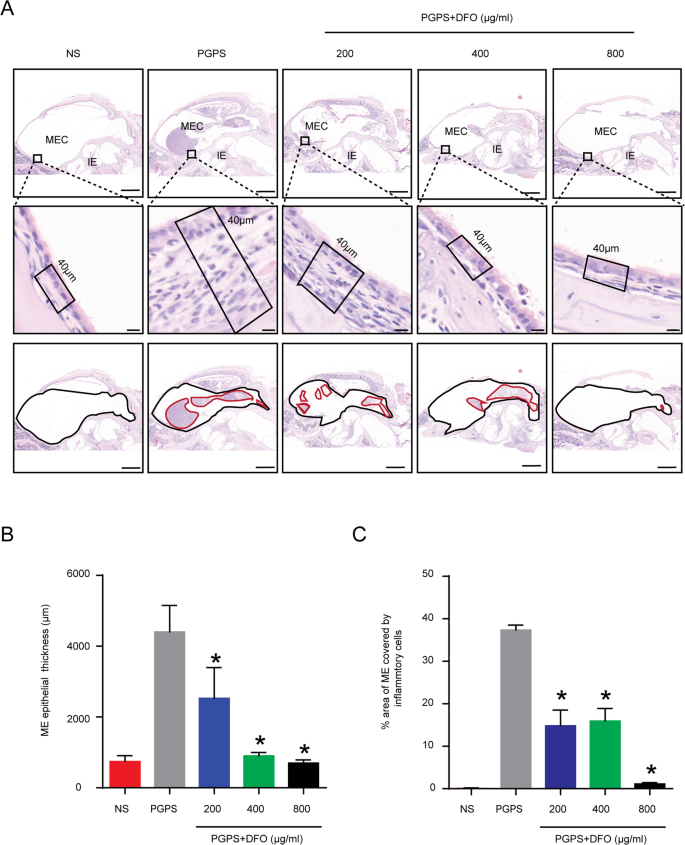 Fig. 3: Hematoxylin-Eosin (H&E) staining shows the histological changes in middle ear epithelium after PGPS injection and various doses of DFO treatment.