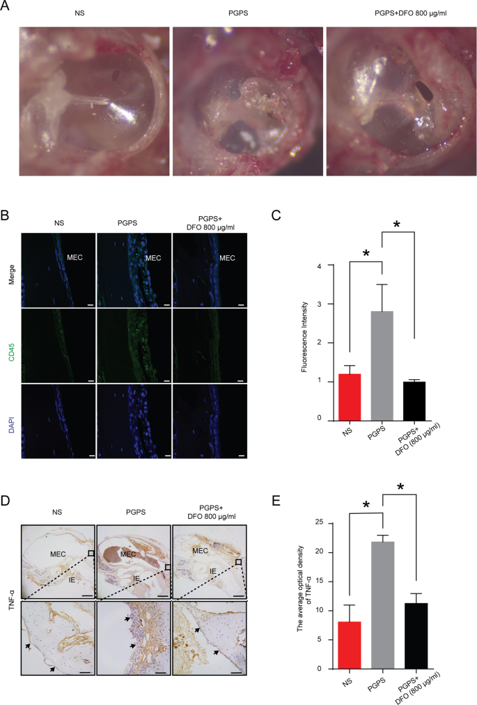 Fig. 4: DFO reduces the OM response induced by PGPS.