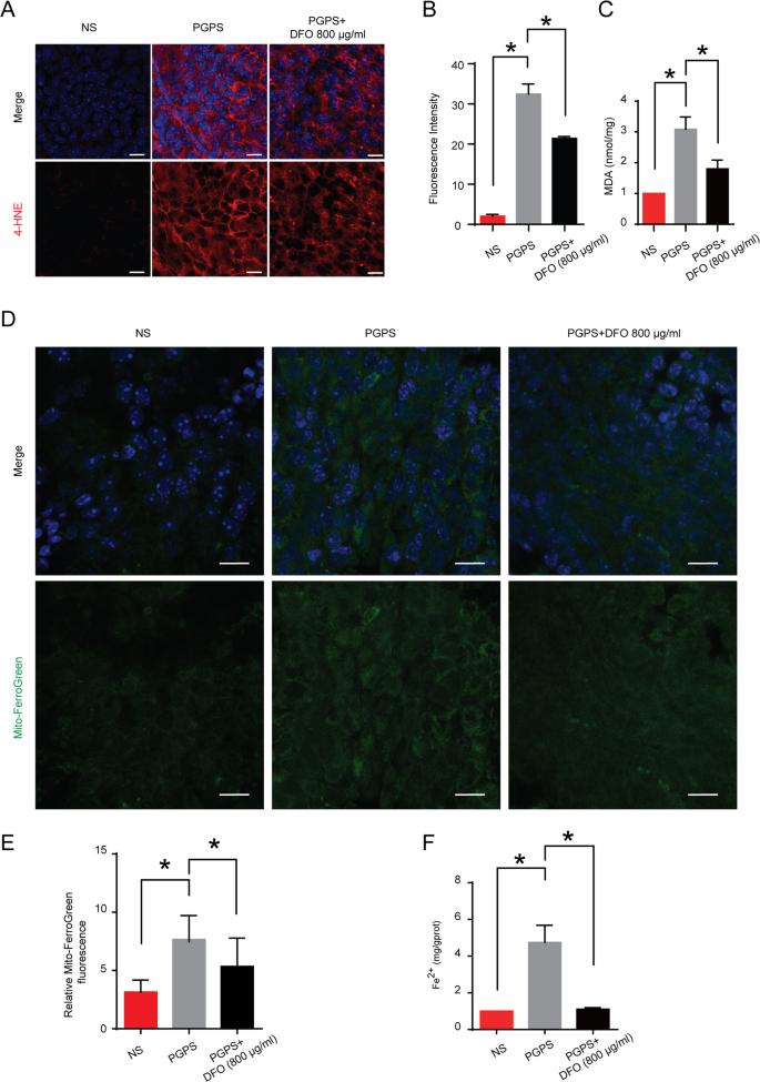 Fig. 5: The effect of DFO on lipid peroxidation and iron accumulation in middle ear epithelial tissue of OM.
