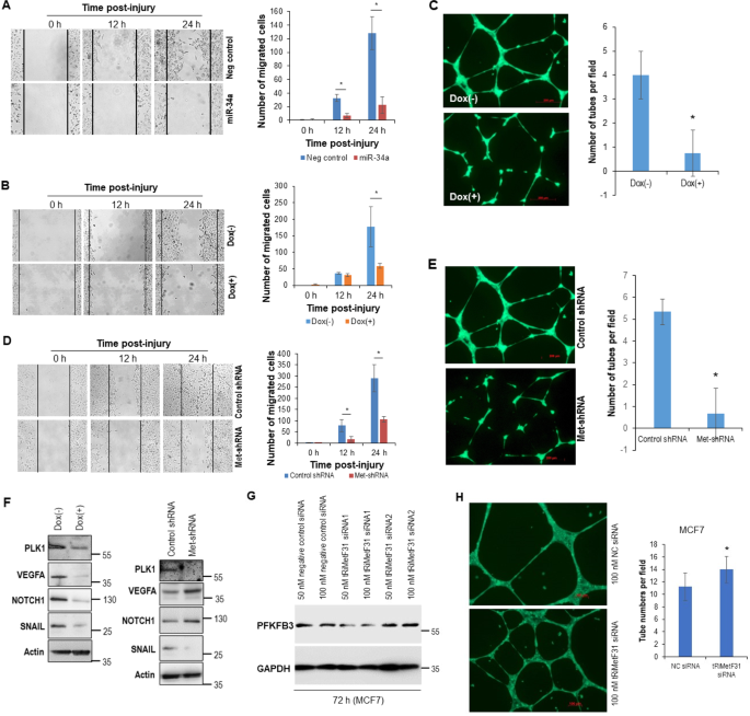 Fig. 6: Both ectopic miR-34a and tRNAiMet knockdown suppressed the migration and angiogenesis of breast cancer cells.