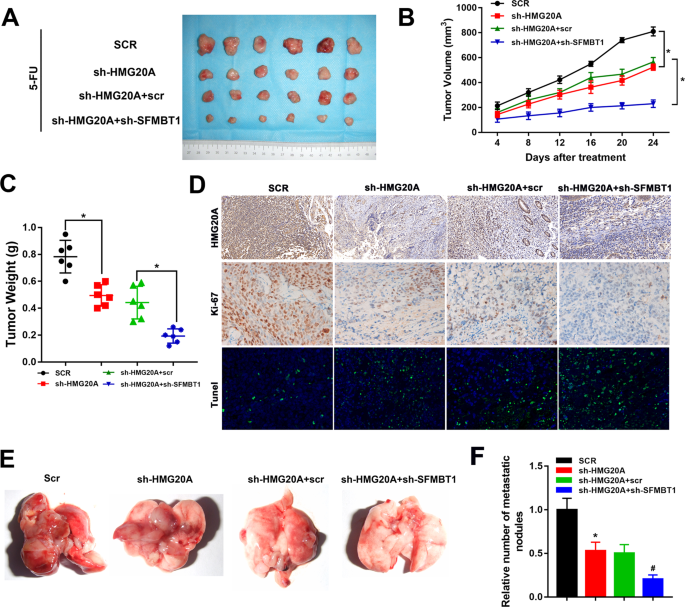 Fig. 7: SFMBT1 in combination with HMG20A promotes the proliferation and metastasis of CRC in vivo.