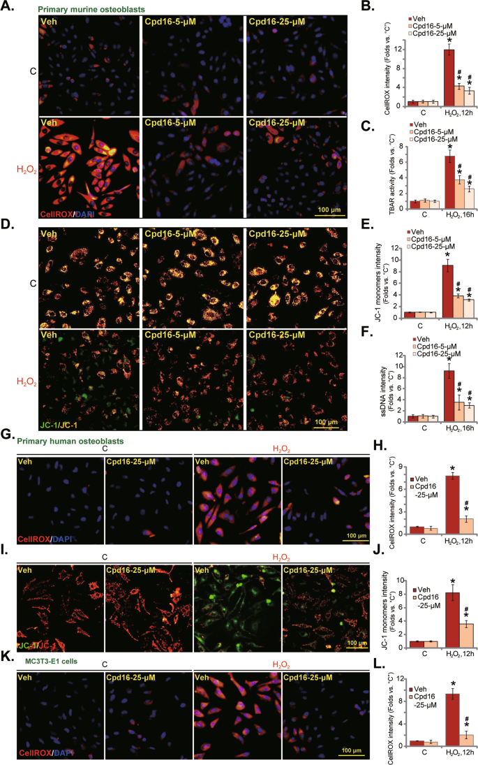 Fig. 2: Cpd16 ameliorates H2O2-provoked oxidative injury in osteoblasts.