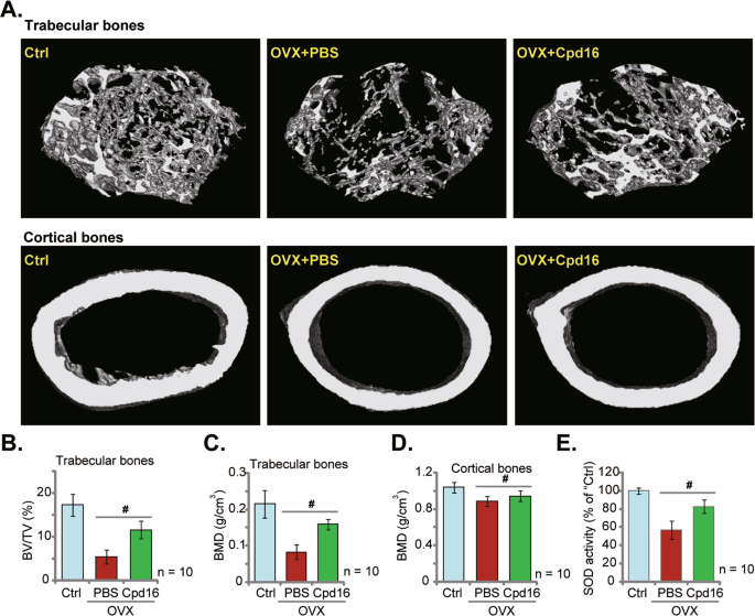 Fig. 8: Cpd16 administration largely ameliorates trabecular bone loss in OVX mice.